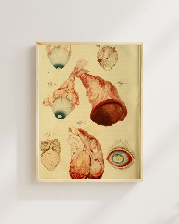 Benjamin Travers - Göz Hastalıkları ve Tedavileri Üzerine Özet Fine Art Baskı